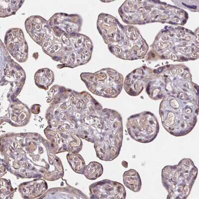 Immunohistochemistry-Paraffin: TMEM88 Antibody [NBP2-13457] - Staining of human placenta shows moderate positivity in trophoblastic cells.