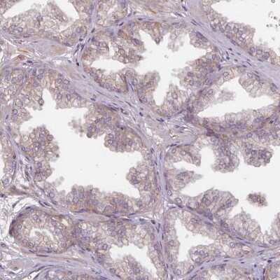 Immunohistochemistry-Paraffin: TMEM88 Antibody [NBP2-13457] - Staining of human prostate shows moderate membranous positivity in glandular cells.