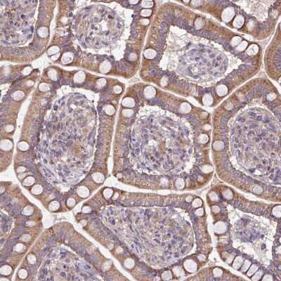 Immunohistochemistry-Paraffin: TMEM88 Antibody [NBP2-13457] - Staining of human small intestine shows moderate positivity in glandular cells.