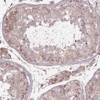 Immunohistochemistry-Paraffin: TMEM88 Antibody [NBP2-13457] - Staining of human testis shows moderate membranous positivity in cells in seminiferous ducts.