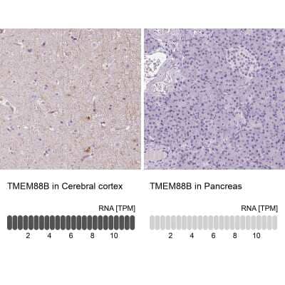 Immunohistochemistry-Paraffin: TMEM88B Antibody [NBP2-38078] - Staining in human cerebral cortex and pancreas tissues using anti-TMEM88B antibody. Corresponding TMEM88B RNA-seq data are presented for the same tissues.