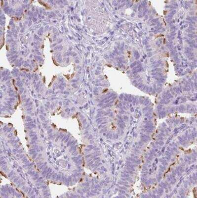 Immunohistochemistry: TMEM89 Antibody [NBP2-30826] - Staining of human fallopian tube shows strong membranous positivity in glandular cells.