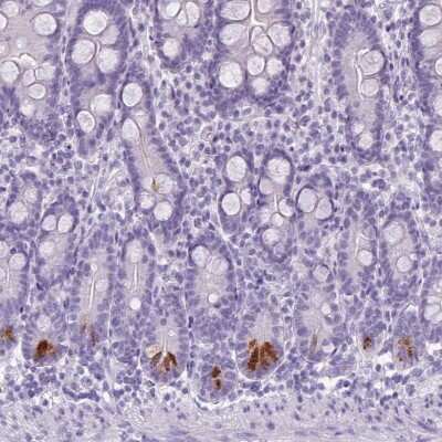 Immunohistochemistry-Paraffin TMEM91 Antibody - BSA Free