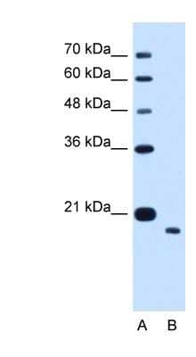 Western Blot: TMEM91 Antibody [NBP1-70730] - HepG2 cell lysate, concentration 1.25ug/ml.