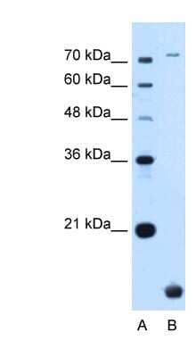 Western Blot: TMEM91 Antibody [NBP1-70731] - HepG2 cell lysate, concentration 0.2-1 ug/ml.