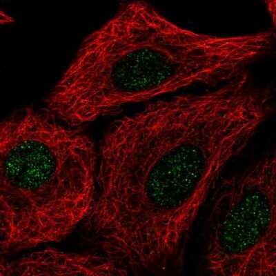 Immunocytochemistry/ Immunofluorescence TMEM92 Antibody - BSA Free