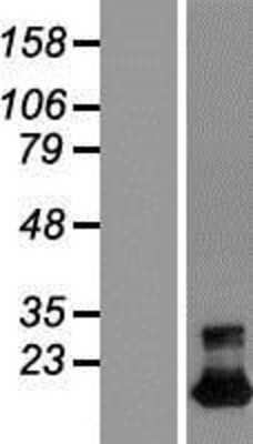 Western Blot: TMEM92 Overexpression Lysate (Adult Normal) [NBL1-17110] Left-Empty vector transfected control cell lysate (HEK293 cell lysate); Right -Over-expression Lysate for TMEM92.