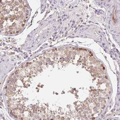 Immunohistochemistry-Paraffin TMEM93 Antibody - BSA Free