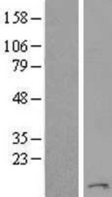 Western Blot TMEM93 Overexpression Lysate