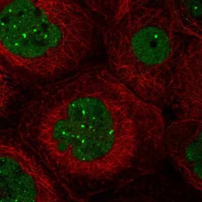 Immunocytochemistry/ Immunofluorescence TMEM94 Antibody - BSA Free