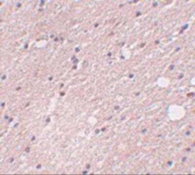 Immunohistochemistry: Preso/FRMPD4 Antibody [NBP2-82035] - Immunohistochemistry of FRMPD4 in human brain tissue with FRMPD4 antibody at 5 ug/mL.