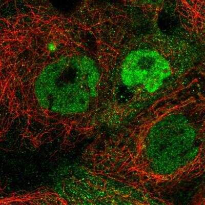 Immunocytochemistry/ Immunofluorescence TMEM98 Antibody - BSA Free