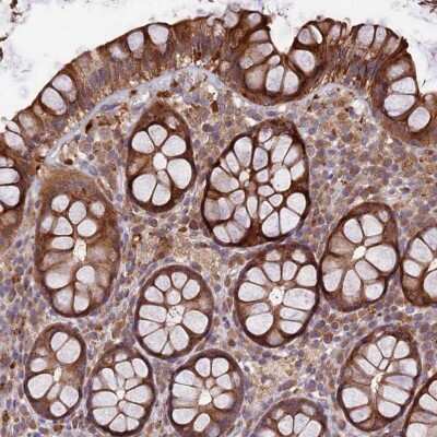 Immunohistochemistry-Paraffin TMEM98 Antibody - BSA Free