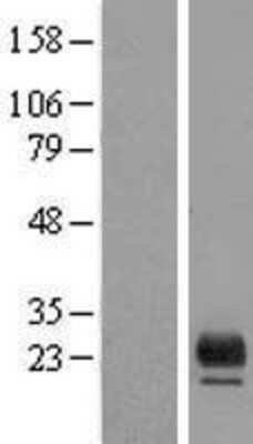 Western Blot: TMEM98 Overexpression Lysate (Adult Normal) [NBP2-08623] Left-Empty vector transfected control cell lysate (HEK293 cell lysate); Right -Over-expression Lysate for TMEM98.