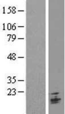 Western Blot: TMEM9B Overexpression Lysate (Adult Normal) [NBL1-17113] Left-Empty vector transfected control cell lysate (HEK293 cell lysate); Right -Over-expression Lysate for TMEM9B.
