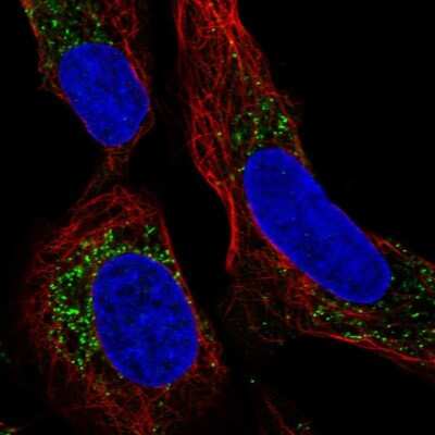 Immunocytochemistry/Immunofluorescence: TMEPAI Antibody [NBP2-56657] - Staining of human cell line U-2 OS shows localization to vesicles.