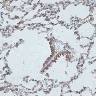 Immunohistochemistry-Paraffin: TMEPAI Antibody [NBP2-94649] - Paraffin-embedded mouse lung using TMEPAI .