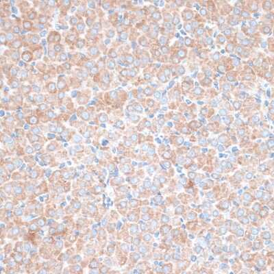 Immunohistochemistry-Paraffin: TMEPAI Antibody [NBP2-94649] - Paraffin-embedded rat ovary using TMEPAI .
