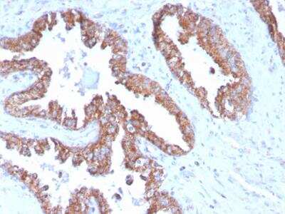 Immunohistochemistry-Paraffin TMEPAI Antibody (PMEPA1/2696) - Azide and BSA Free