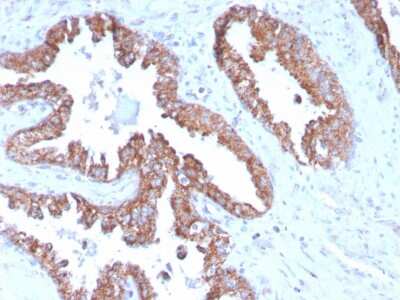 Immunohistochemistry-Paraffin TMEPAI Antibody (PMEPA1/2696)