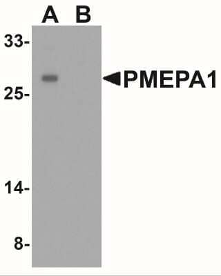Western Blot: TMEPAI Antibody [NBP2-41321] - Analysis of PMEPA1 inA549 cell lysate with PMEPA1 antibody at 1 ug/ml in (A) the absence and (B) the presence of blocking peptide.