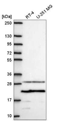 Western Blot: TMEPAI Antibody [NBP2-56657] - Western blot analysis in human cell line RT-4 and human cell line U-251 MG.