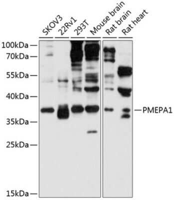 Western Blot: TMEPAI Antibody [NBP2-93857] - Analysis of extracts of various cell lines, using TMEPAI at 1:3000 dilution. Secondary antibody: HRP Goat Anti-Rabbit IgG (H+L) at 1:10000 dilution. Lysates/proteins: 25ug per lane. Blocking buffer: 3% nonfat dry milk in TBST. Detection: ECL Basic Kit . Exposure time: 30s.