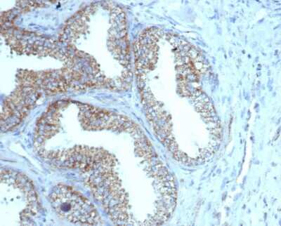 Immunohistochemistry-Paraffin: TMEPAI Antibody (rPMEPA1/6422) - Azide and BSA Free [NBP3-08259] - Formalin-fixed, paraffin-embedded human prostate stained with TMEPAI Recombinant Mouse Monoclonal (rTMEPAI/6422).