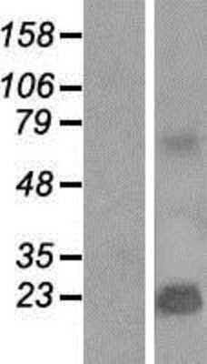 Western Blot: TMEPAI Overexpression Lysate (Adult Normal) [NBP2-04645] Left-Empty vector transfected control cell lysate (HEK293 cell lysate); Right -Over-expression Lysate for TMEPAI.