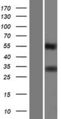 Western Blot: TMEPAI Overexpression Lysate (Adult Normal) [NBP2-06679] Left-Empty vector transfected control cell lysate (HEK293 cell lysate); Right -Over-expression Lysate for TMEPAI.