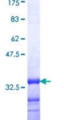 Western Blot: TMIE Partial Recombinant Protein [h00259236-Q01]