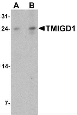 Western Blot TMIGD1 Antibody - BSA Free