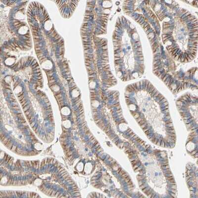 Immunohistochemistry-Paraffin: TMIGD2 Antibody [NBP1-81164] - Staining of human duodenum shows distinct membranous positivity in glandular cells.