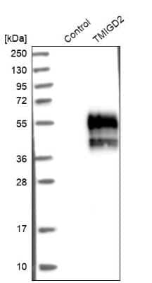 Western Blot: TMIGD2 Antibody [NBP1-81164] - Analysis in control (vector only transfected HEK293T lysate) and TMIGD2 over-expression lysate (Co-expressed with a C-terminal myc-DDK tag (3.1 kDa) in mammalian HEK293T cells).