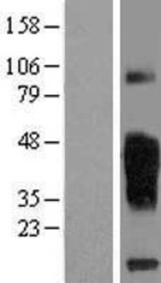 Western Blot: TMIGD2 Overexpression Lysate (Adult Normal) [NBL1-17114] Left-Empty vector transfected control cell lysate (HEK293 cell lysate); Right -Over-expression Lysate for TMIGD2.