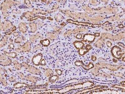 Immunohistochemistry-Paraffin TMLHE Antibody