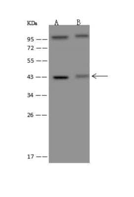 Western Blot TMLHE Antibody