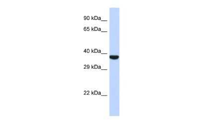 Western Blot: TMPPE Antibody [NBP2-83700] - Host: Rabbit. Target Name: TMPPE. Sample Type: 721_B Whole cell lysates. Antibody Dilution: 1.0ug/ml