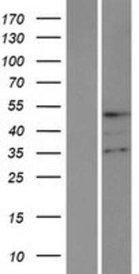 Western Blot: TMPPE Overexpression Lysate (Adult Normal) [NBP2-08531] Left-Empty vector transfected control cell lysate (HEK293 cell lysate); Right -Over-expression Lysate for TMPPE.