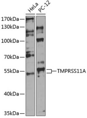 Western Blot: TMPRSS11A Antibody [NBP2-93093] - Analysis of extracts of various cell lines, using TMPRSS11A at 1:1000 dilution. Secondary antibody: HRP Goat Anti-Rabbit IgG (H+L) at 1:10000 dilution. Lysates/proteins: 25ug per lane. Blocking buffer: 3% nonfat dry milk in TBST. Detection: ECL Basic Kit . Exposure time: 60s.