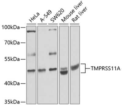 Western Blot: TMPRSS11A Antibody [NBP2-94784] - Analysis of extracts of various cell lines, using TMPRSS11A at 1:1000 dilution. Secondary antibody: HRP Goat Anti-Rabbit IgG (H+L) at 1:10000 dilution. Lysates/proteins: 25ug per lane. Blocking buffer: 3% nonfat dry milk in TBST. Detection: ECL Basic Kit . Exposure time: 15s.