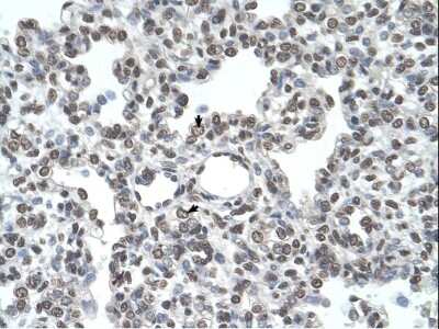 Immunohistochemistry-Paraffin: Airway Trypsin-like Protease/HAT/TMPRSS11D Antibody [NBP1-62546] -  Human Lung Tissue, antibody concentration 4-8 ug/ml.  Cells with positive label: Aveolar cells (indicated with arrows) 400X magnification.