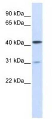 Western Blot: Airway Trypsin-like Protease/HAT/TMPRSS11D Antibody [NBP1-62546] -  293T Cell Lysate 1ug/ml Gel Concentration 12%