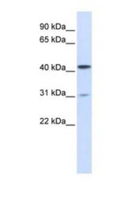 Western Blot: Airway Trypsin-like Protease/HAT/TMPRSS11D Antibody [NBP1-69558] - 293T tissue lysate at a concentration of 1ug/ml.