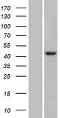 Western Blot: Airway Trypsin-like Protease/HAT/TMPRSS11D Overexpression Lysate [NBP2-07891] -  Left-Empty vector transfected control cell lysate (HEK293 cell lysate); Right -Over-expression Lysate for TMPRSS11D.