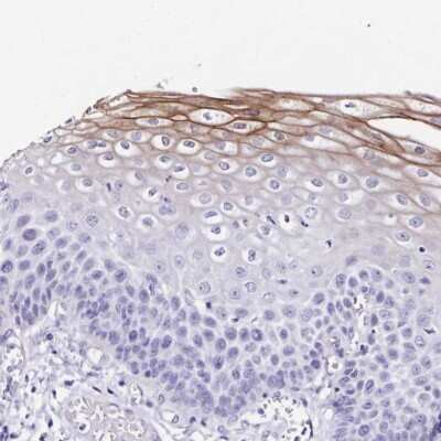 Immunohistochemistry: TMPRSS11E Antibody [NBP2-48995] - Staining of human esophagus shows moderate membranous positivity in superficial layer of squamous epithelial cells.