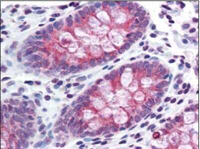 Immunohistochemistry-Paraffin: TMPRSS4 Antibody [NBP1-50175] - Staining of paraffin-embedded human colon with TMPRSS4 antibody at concentration 15 ug/ml.