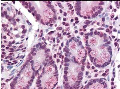 Immunohistochemistry-Paraffin: TMPRSS4 Antibody [NBP1-50175] - Staining of paraffin-embedded human colon with TMPRSS4 antibody at concentration 15 ug/ml.