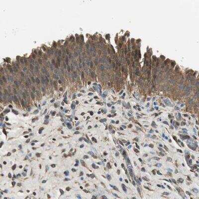 Immunohistochemistry-Paraffin: TMPRSS4 Antibody [NBP1-82608] - Staining of human urinary bladder with TMPRSS4 Antibody shows cytoplasmic positivity in urothelial cells.