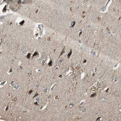 Immunohistochemistry-Paraffin: TMPRSS4 Antibody [NBP1-82608] - Staining of human Cerebral cortex shows strong cytoplasmic positivity in neuronal cells.